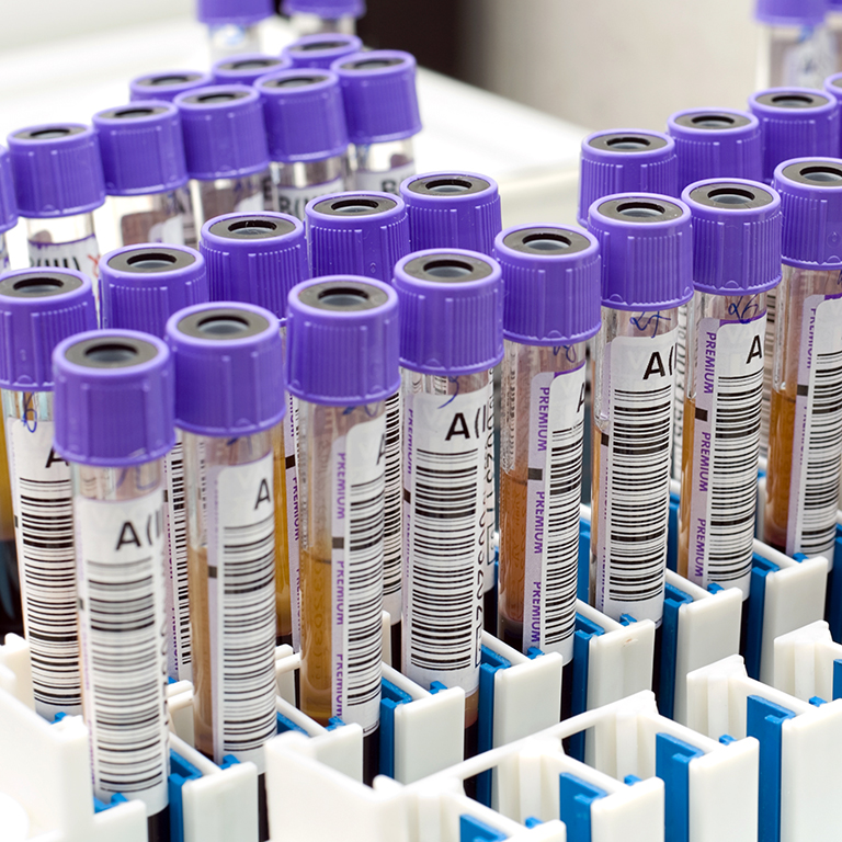 Laboretiketten geeignet für Zentrifugen